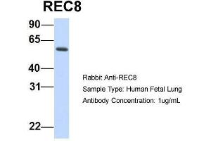 Host:  Rabbit  Target Name:  REC8  Sample Type:  Human Fetal Lung  Antibody Dilution:  1. (REC8 Antikörper  (N-Term))