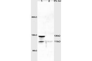 Lane 1: rat lung lysates Lane 2: rat brain lysates probed with Anti NOS-2/iNOS Polyclonal Antibody, Unconjugated (ABIN725675) at 1:200 in 4 °C. (NOS2 Antikörper)