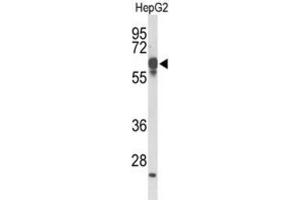 Western Blotting (WB) image for anti-F-Box and Leucine-Rich Repeat Protein 5 (FBXL5) antibody (ABIN3004167)
