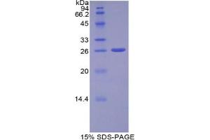 SDS-PAGE analysis of Human ADAM10 Protein. (ADAM10 Protein)