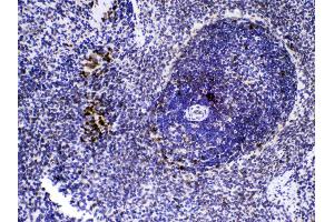 Immunohistochemistry (IHC) image for anti-Caspase 8 (CASP8) (AA 410-449), (N-Term) antibody (ABIN4886501)
