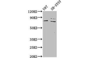 Western Blot Positive WB detected in: U87 whole cell lysate, SH-SY5Y whole cell lysate All lanes: TIPARP antibody at 4.