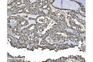 IHC analysis of P4HB using anti-P4HB antibody (ABIN7600075).