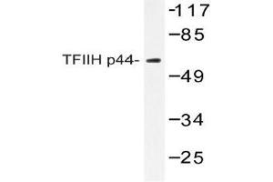 Western blot (WB) analysis of TFIIH p44 antibody in extracts from COLO205