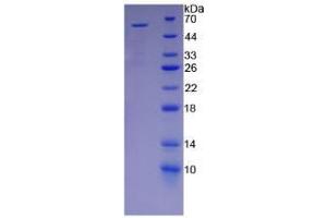 SDS-PAGE analysis of Human KIR2DS2 Protein. (KIR2DS2 Protein)