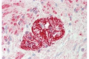 Rabbit Anti-KLHL25 antibody  Formalin Fixed Paraffin Embedded Tissue: Human Colon, Myenteric Plexus Primary antibody Concentration: 1:100 Secondary Antibody: Donkey anti-Rabbit-Cy3 Secondary Antibody Concentration: 1:200 Magnification: 20x Exposure Time: 0. (KLHL25 Antikörper  (N-Term))