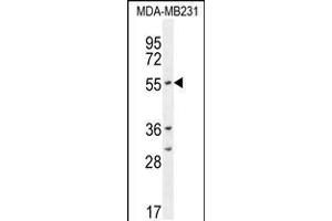 Western blot analysis in MDA-MB231 cell line lysates (35ug/lane). (CYP2A7 Antikörper  (AA 121-148))