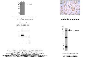 Image no. 1 for anti-Hypoxia Inducible Factor 1, alpha Subunit (Basic Helix-Loop-Helix Transcription Factor) (HIF1A) (AA 432-528) antibody (ABIN363203) (HIF1A Antikörper  (AA 432-528))