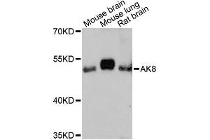 Western blot analysis of extracts of various cell lines, using AK8 antibody (ABIN6292827) at 1:3000 dilution. (AK8 Antikörper)