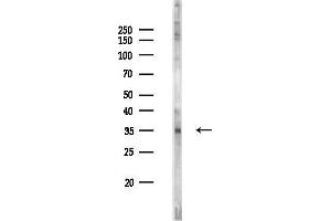 anti-5-Hydroxytryptamine (serotonin) Receptor 5B (HTR5B) antibody