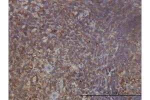 Immunoperoxidase of monoclonal antibody to RPL9 on formalin-fixed paraffin-embedded human tonsil tissue. (RPL9 Antikörper  (AA 93-191))
