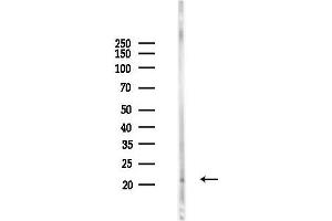 anti-SERTA Domain Containing 3 (SERTAD3) antibody