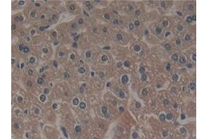 Detection of NCF4 in Mouse Liver Tissue using Polyclonal Antibody to Neutrophil Cytosolic Factor 4 (NCF4) (NCF4 Antikörper  (AA 111-339))