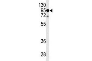 Western blot analysis of TLR4 antibody and HL-60 lysate. (TLR4 Antikörper  (AA 669-698))