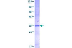 SPINK1 Protein (AA 1-79) (GST tag)