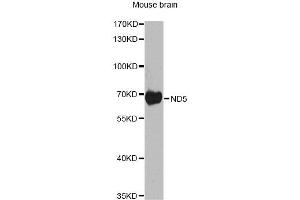 Western blot analysis of extracts of mouse brain, using ND5 antibody. (MT-ND5 Antikörper)