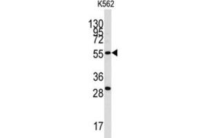 Western Blotting (WB) image for anti-Chloride Intracellular Channel 5 (CLIC5) antibody (ABIN3003306)