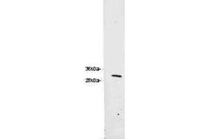 Western blot of  Anti-RFP Antibody. (RFP Antikörper)