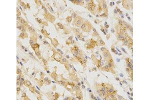 Immunohistochemistry of paraffin-embedded Human stomach using GGA2 Polyclonal Antibody at dilution of 1:200 (40x lens).