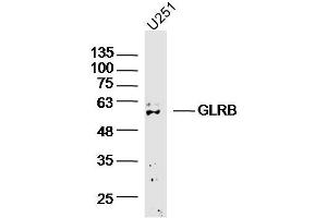 U251 cell lysates probed with GLRB Polyclonal Antibody, Unconjugated (bs-20450R) at 1:300 overnight at 4˚C. (GLRB Antikörper  (AA 51-150))