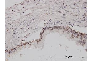 Immunoperoxidase of monoclonal antibody to CSE1L on formalin-fixed paraffin-embedded human prostate. (Exportin 2 Antikörper  (AA 872-971))