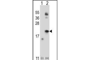 Western blot analysis of IL21 (arrow) using rabbit polyclonal IL21 Antibody (C-term) (ABIN657761 and ABIN2846740). (IL-21 Antikörper  (C-Term))