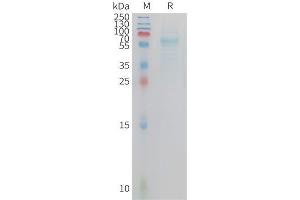 SDS-PAGE (SDS) image for Triggering Receptor Expressed On Myeloid Cells 2 (TREM2) (AA 19-174) protein (Fc Tag) (ABIN7538569)