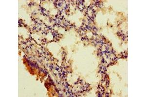 Immunohistochemistry of paraffin-embedded human lung tissue using ABIN7167709 at dilution of 1:100 (RGMA Antikörper  (AA 153-408))