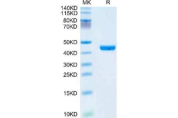 CHI3L1 Protein (AA 22-383) (His tag)