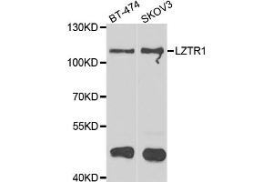 Western blot analysis of extracts of various cell lines, using LZTR1 antibody (ABIN4904276) at 1:1000 dilution. (LZTR1 Antikörper)