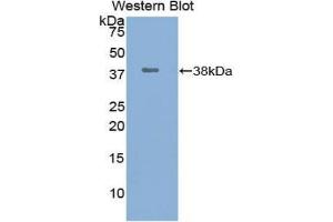 Western blot analysis of the recombinant protein. (UCHL5 Antikörper  (C-Term))