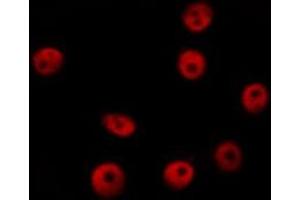 ABIN6276536 staining HepG2? (CTCF Antikörper  (C-Term))