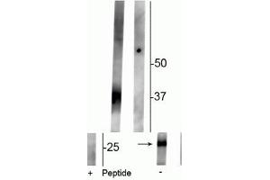 Western blot of rat kidney lysate showing specific immunolabeling of the ~29 kDa and 37 kDa glycosylated form of the AQP2 protein phosphorylated at Ser261 in the first lane (-).