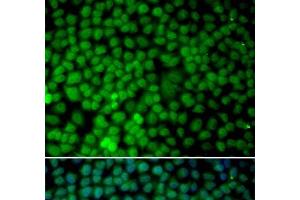 Immunofluorescence analysis of MCF-7 cells using RBX1 Polyclonal Antibody (RBX1 Antikörper)