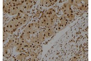 ABIN6275419 at 1/100 staining Human kidney tissue by IHC-P. (S100A3 Antikörper  (Internal Region))
