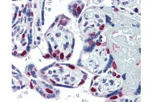 Anti-PARP antibody IHC of human placenta.