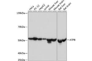 Western blot analysis of extracts of various cell lines, using ATPB Rabbit mAb (ABIN7265722) at 1:1000 dilution. (ATP5B Antikörper)
