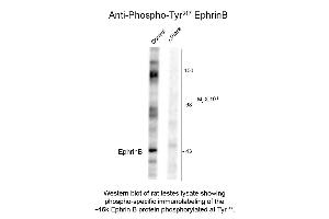 Western Blot of Anti-EphrinB pT317 (Rabbit) Antibody - 600-401-D36 Western Blot of Anti-EphrinB pT317 (Rabbit) Antibody. (Ephrin B Antikörper  (pTyr317))