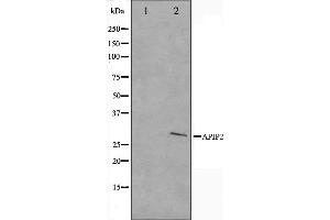 Western blot analysis on COLO205 cell lysate using APAF1 Antibody. (APAF1 Antikörper  (C-Term))