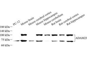 Western blot analysis of ADAM23 (ABIN7072942) at dilution of 1: 500 (Adam23 Antikörper)