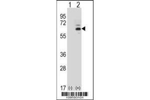 Western blot analysis of FASTK using rabbit polyclonal FASTK Antibody using 293 cell lysates (2 ug/lane) either nontransfected (Lane 1) or transiently transfected (Lane 2) with the FASTK gene. (FASTK Antikörper  (C-Term))