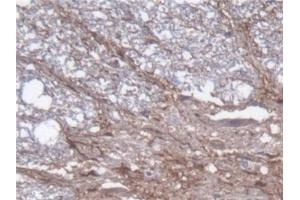 Detection of GFAP in Rat Spinal cord Tissue using Polyclonal Antibody to Glial Fibrillary Acidic Protein (GFAP) (GFAP Antikörper  (AA 1-430))