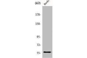 Western Blot analysis of HuvEc cells using MMP-19 Polyclonal Antibody (MMP19 Antikörper  (N-Term))