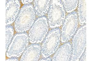ABIN6260703 and ABIN6268787 at 1/100 staining Rat testis tissue by IHC-P.