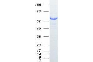 KEAP1 Protein (Transcript Variant 1) (Myc-DYKDDDDK Tag)