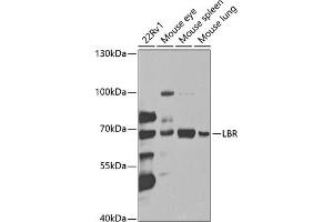 Western blot analysis of extracts of various cell lines, using LBR antibody (ABIN6128194, ABIN6143105, ABIN6143106 and ABIN6221130) at 1:1000 dilution. (Lamin B Receptor Antikörper  (AA 1-211))