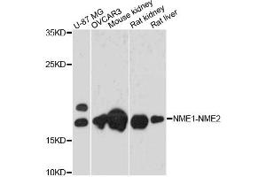 Western blot analysis of extracts of various cell lines, using NME1-NME2 antibody.