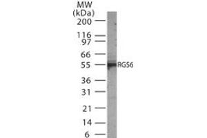 Image no. 1 for anti-Regulator of G-Protein Signaling 6 (RGS6) (AA 182-198) antibody (ABIN233211) (RGS6 Antikörper  (AA 182-198))