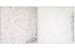 Immunohistochemistry analysis of paraffin-embedded human brain tissue, using PAK7 antibody. (PAK7 Antikörper  (C-Term))