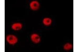 ABIN6277211 staining HepG2 by IF/ICC. (Histone 3 Antikörper  (H3R8me2))